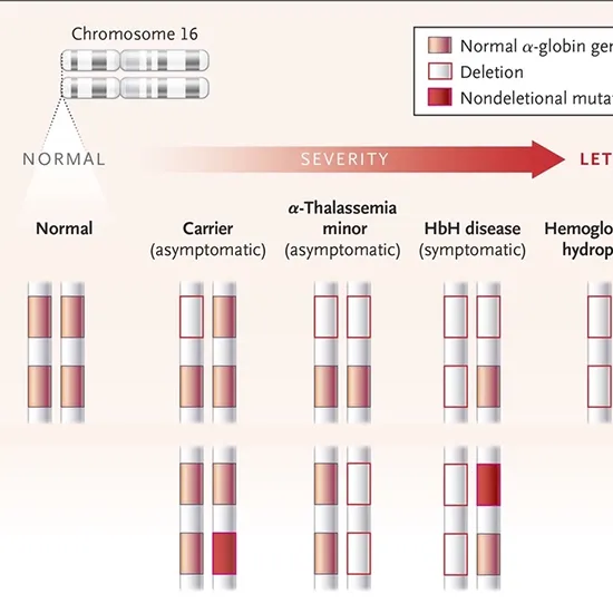 Alpha Thalassemia Mutation Test